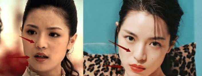 整容最成功的女明星 明明不知道動過多少刀子 但卻毫無痕迹 看新聞