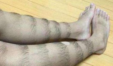 衰老|男性的衰老,倘若你下面有这几种表现,就要注意了