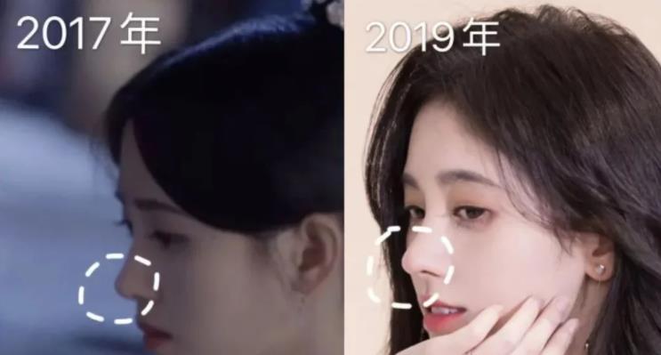 陈数|8位动脸女星，鞠婧祎塌鼻变翘，陈数被赞旗袍女王