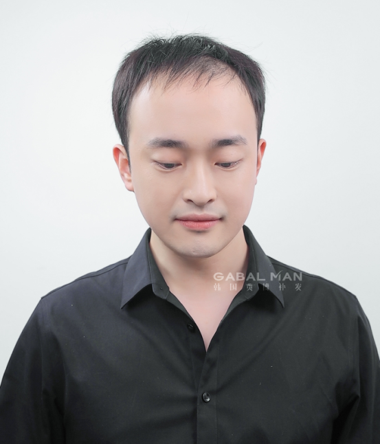 秃头|没想到秃头有这6个好处！看完瞬间不自卑了