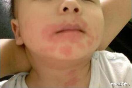 职场宝妈育儿|有种“敷衍”叫湿巾纸擦屁屁,妈妈是方便省事,可宝宝很受伤