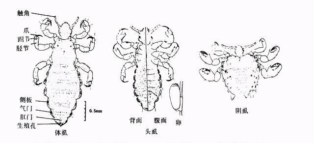 人类褪去全身的毛发后,为什么留下头部、腋下和隐私部位的毛发?