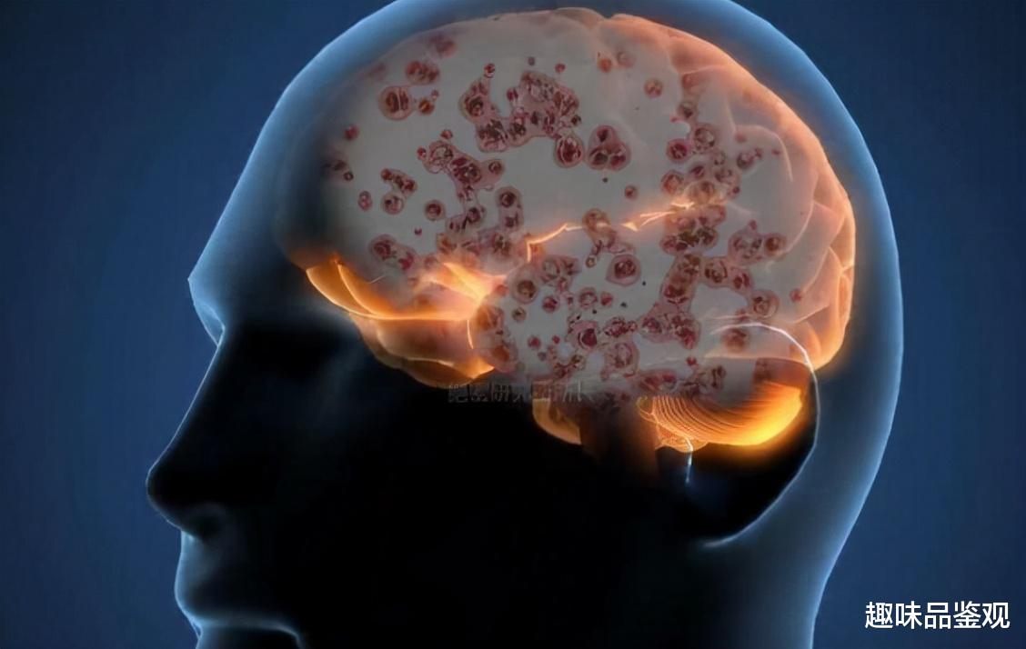 支配人类意识的生物真的存在?30%的人已被感染,并成为携带者