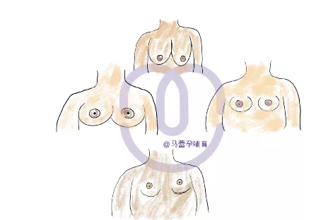 婴幼儿常识|国药育儿知识:小胸会影响妈妈母乳喂养吗?你需要这篇文章!