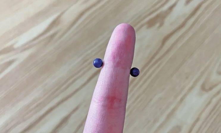 急诊室老苗|“益智玩具”导致孩子肠穿孔？曾被央视多次点名，很多小孩仍在玩