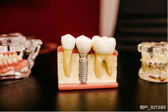 牙齿|我朋友装假牙,结果破产了!