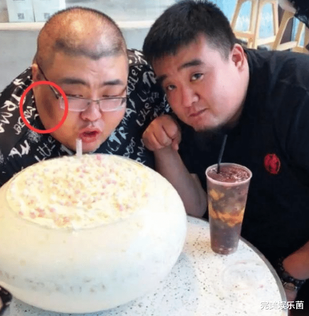 心绞痛|吃播疯狂史:有人牙齿烂掉,有人英年早逝,有人痛苦难忍,谁的错