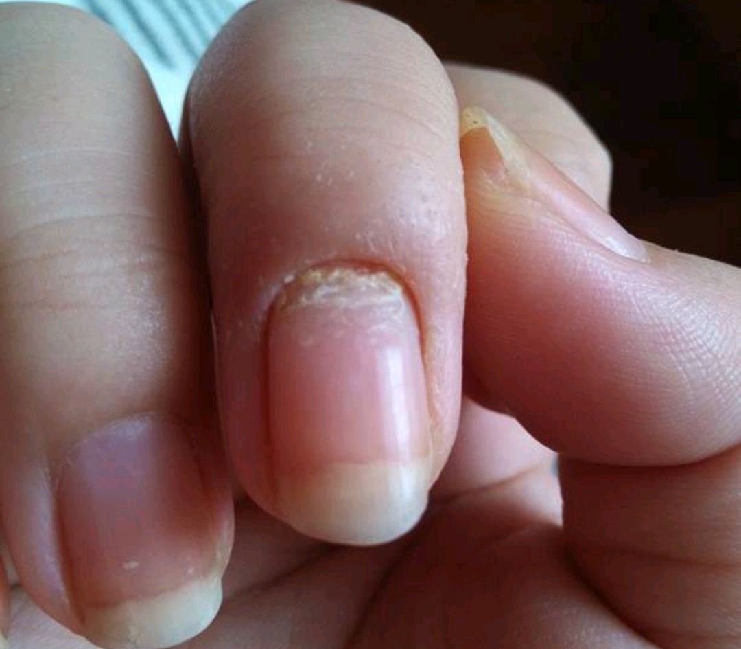 健康无价|男性睡前的3个行为，比喝酒伤肝，有一个就要改掉一个