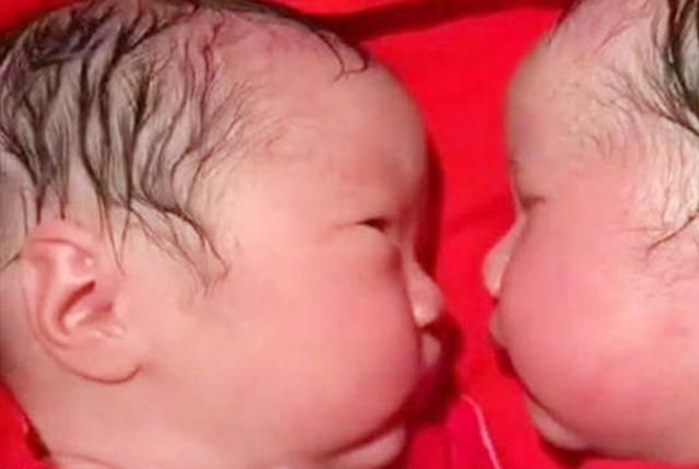西红柿妈谈育|双胞胎姐妹出生15分钟，妹妹对姐姐这个动作，把在场很多人感动了