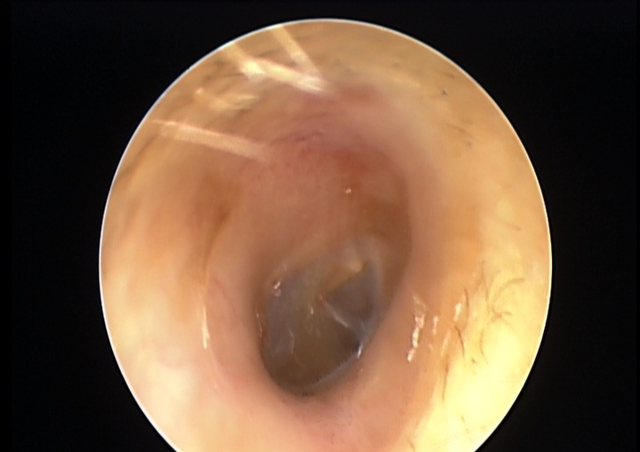 城市的时代 男子常掏耳朵，不料可怕一幕出现：里面竟长满密密麻麻的……