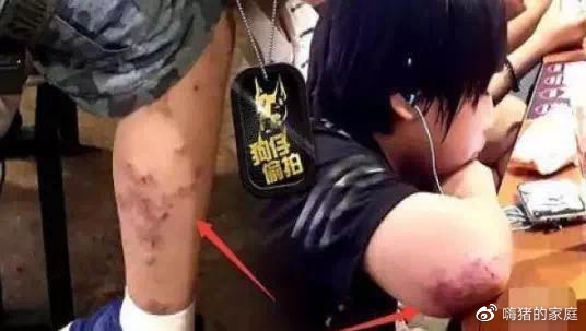 温兆宇|6岁身价1800万，却身无分文、手脚溃烂：他是最火童星，也是父亲的摇钱树