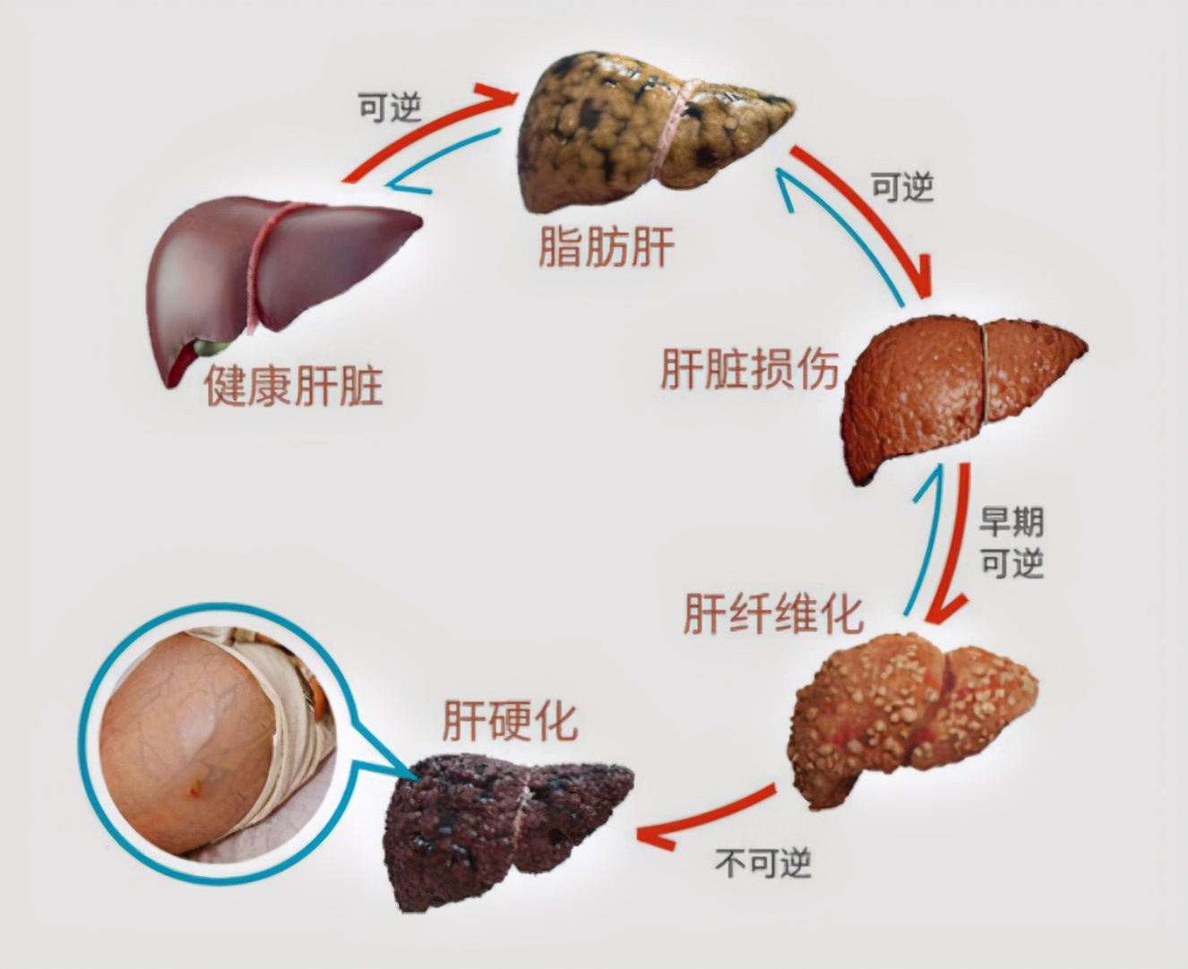 金兰中医学社|吃一口等于3根黄瓜，医生：没事常吃，养肝祛毒，还你婴儿“红润肝”