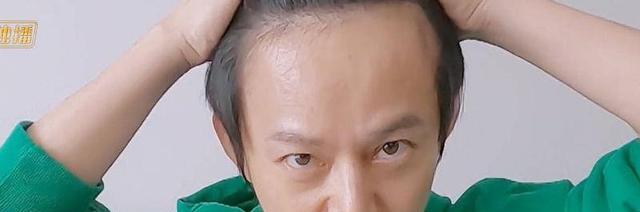 明星|为了发量女明星们有多拼命？