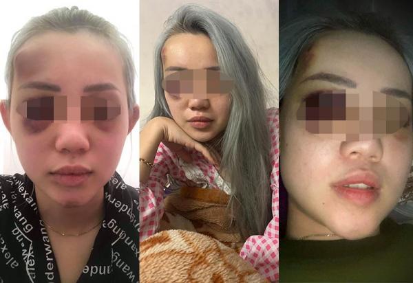 睹图 男子将追求4年的女友娶回家后开始家暴,被捕后称是为了留住她