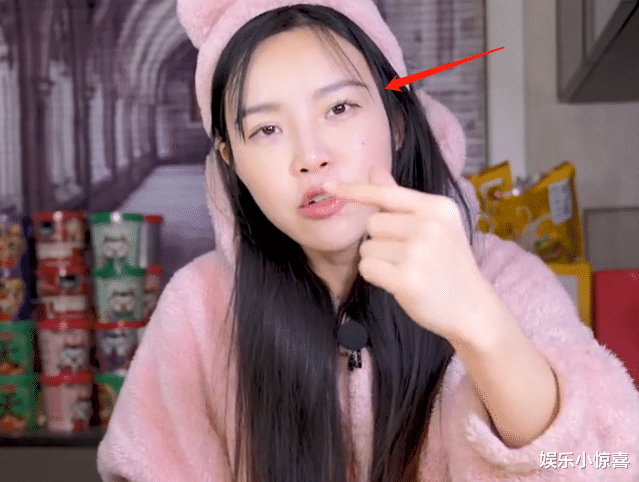 小贝|网红小贝饿了状态越来越差，眼袋红肿、脖子有结块，疑似结婚了