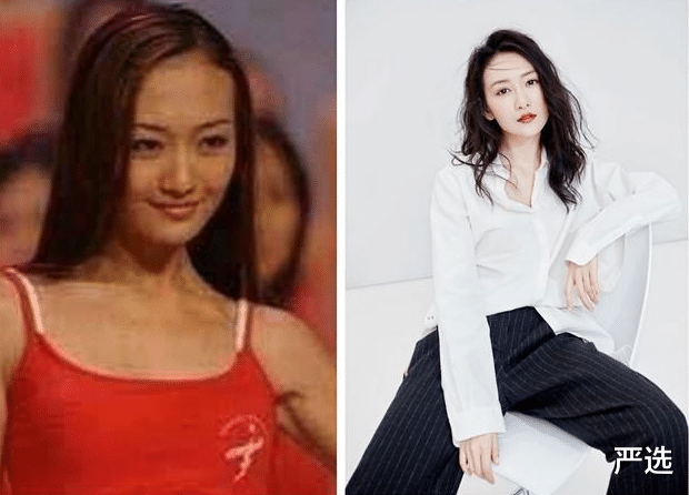 严选|河南女子花8000美白，两月后竟变“包公脸”？医生：难以恢复