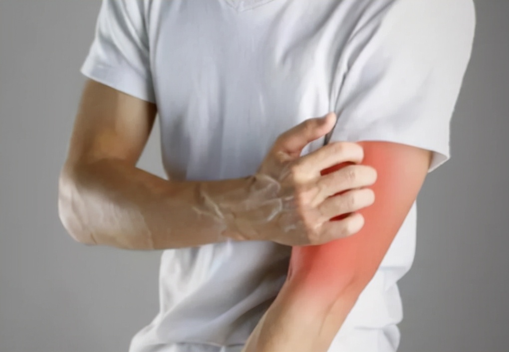 肝脏|28岁男子皮肤过敏,查出肝癌,肝科主任提醒:身上3处异常,早查CT