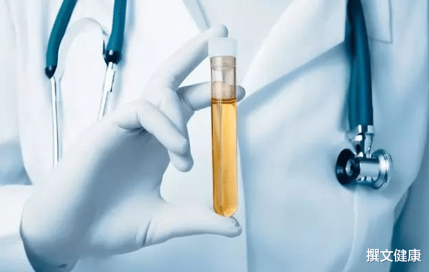 睡眠|睡觉时有3种异常，可能尿酸已经“超标”了，医生：稳定尿酸，谨记“2件事”