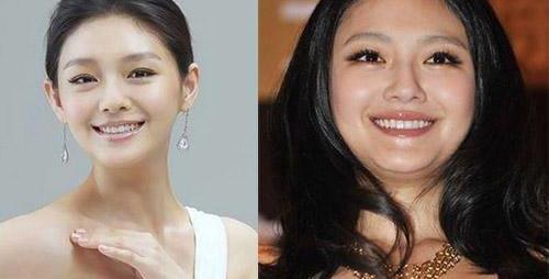 郑爽|女性到底是发福好看，还是瘦了好看，没有对比就没有伤害