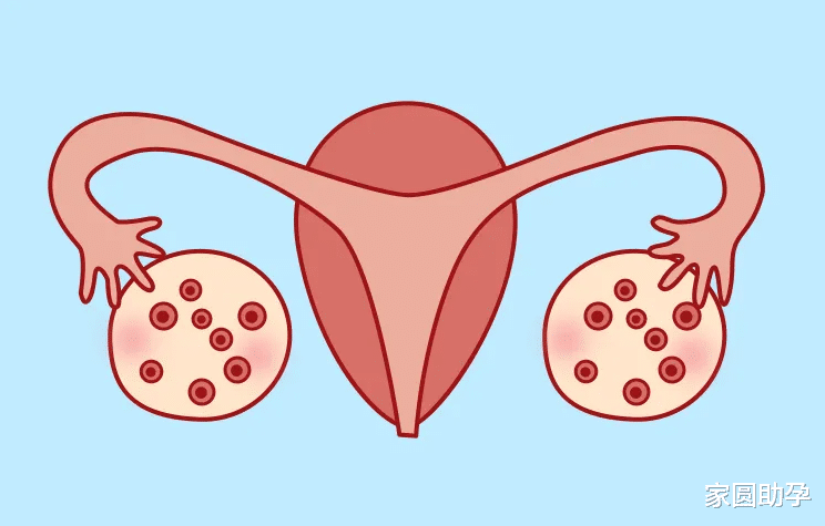 家圆助孕|多囊患者如何减重才能成功怀娃?看完专家建议离好孕就不远了~