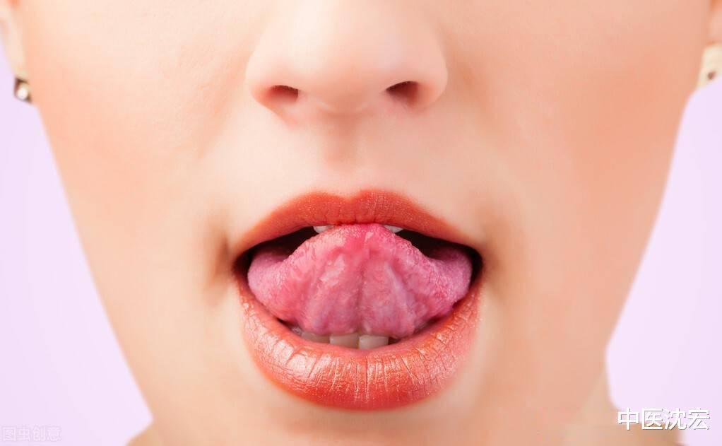 运动|这个通理解表、疏风退热的中成药，感冒、失眠、虚不受补皆可用