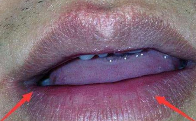 天天听健康|男性身体出现“2黑2粗”,可能肺已经已经严重受损,你若没有,肺还“强壮”