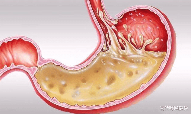 饮食|怎样正确的吃谷维素和维生素B12呢？医生给出建议