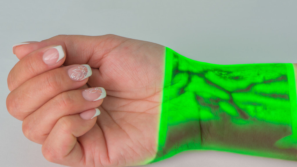 谈健|青筋多由哪些因素导致的？冒青筋意味着什么呢？医生一文说清