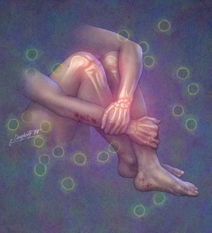 基因 干细胞疗法，在诸多女性大受困扰的自身免疫性疾病面前大有可为！