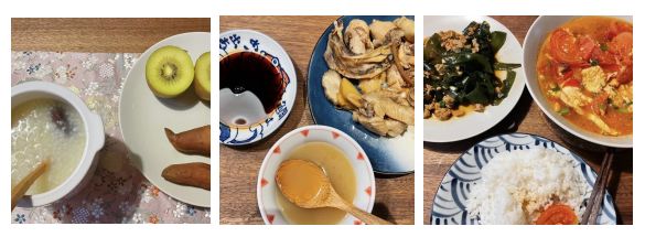 夏小可育儿|不想长妊娠纹?坚持做对4件事,妊娠纹都会绕着你走!医生都夸好