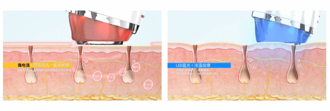 运动|“护肤神器”会“毁容”，盲目跟风购买美容仪后，网友：追悔莫及