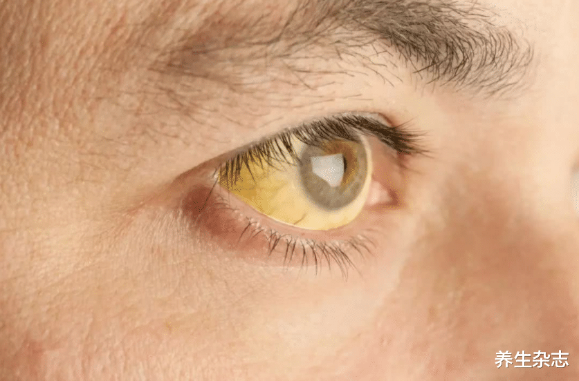 肝脏|肝脏爱一种“水”，不是枸杞水，若能爱喝，清肝火除肝毒，肝干净如新