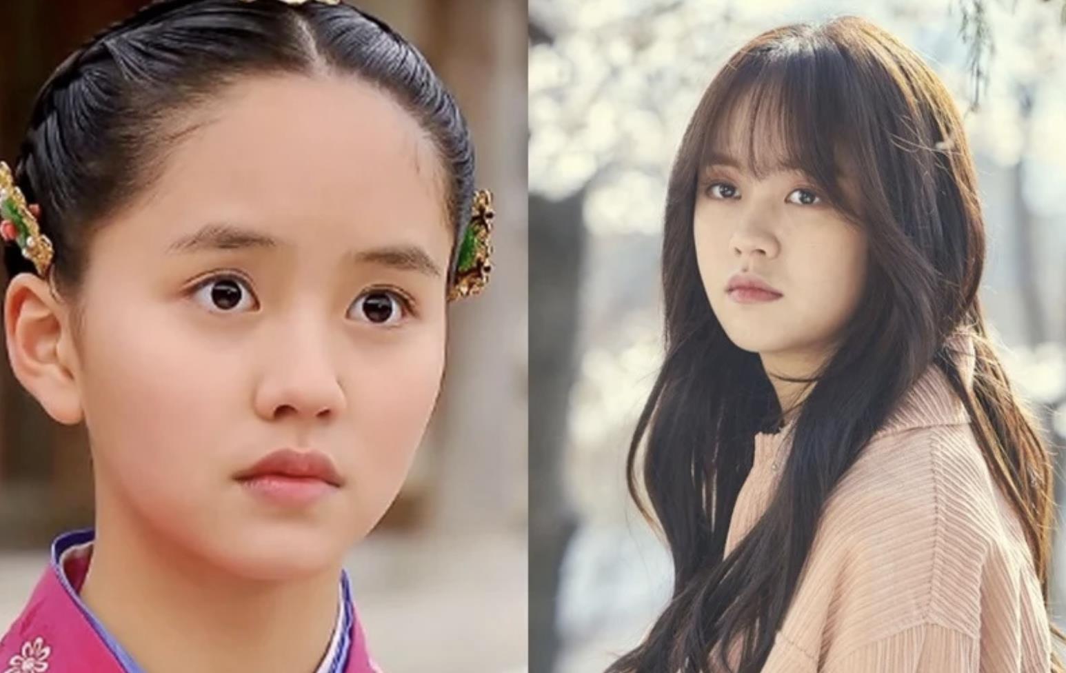 童星|7位“长大颜值更高的童星”，李世荣天然美，俞承豪颜值翻倍