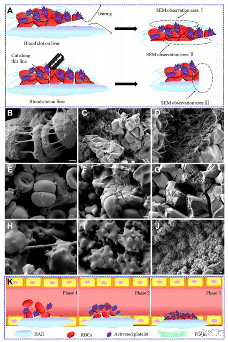 《Science子刊》第三军医大学罗高兴:可见光交联的载有蛇提取物的止血生物粘附凝胶