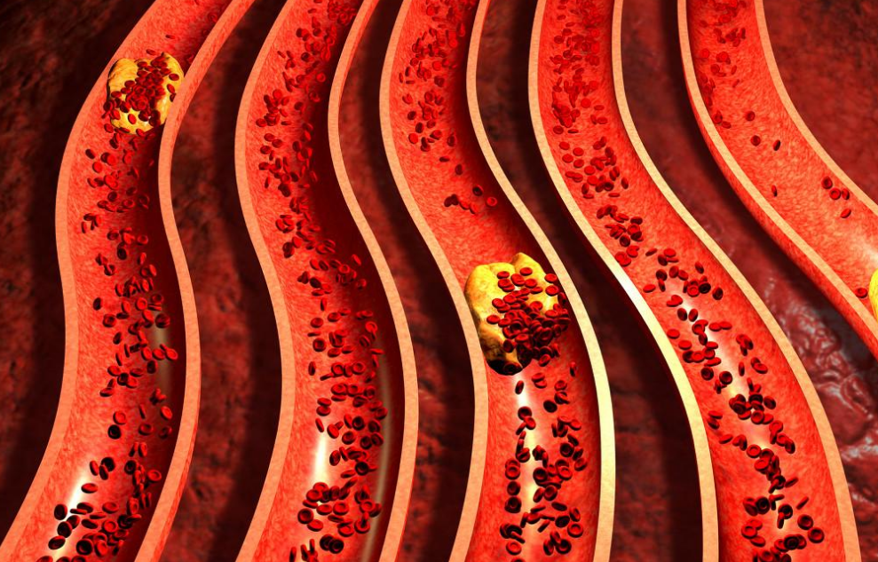 医线天|多家医院联合呼吁停止食用,3种“肉”比烟酒还毁血管,趁早远离