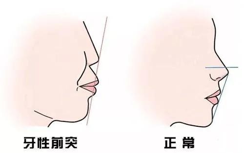 瘦脸|什么脸型瘦了不好看