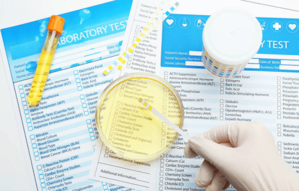 肾病|肾病停药后就反复？问题出在这！认清3点少走很多弯路