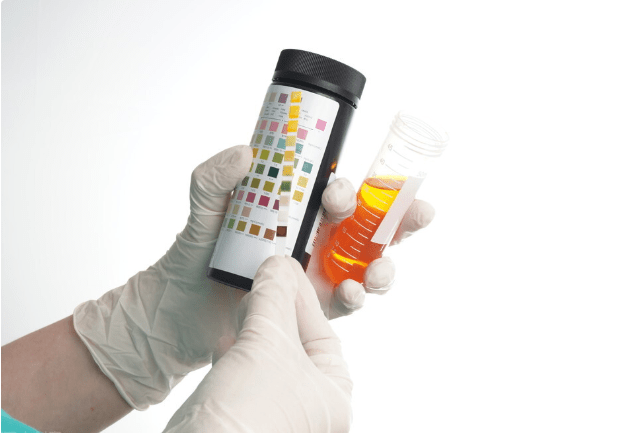 肾病|这项尿液指标异常,是肾病危险信号!从2点下手,严防肾衰