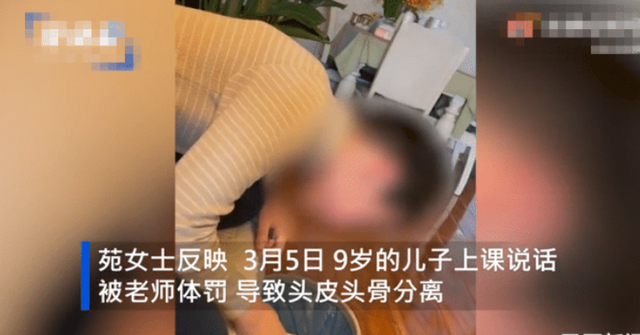 亚洲播报一姐 河南9岁男童遭老师体罚，头皮头骨分离构成二级轻伤，涉事老师已被刑拘