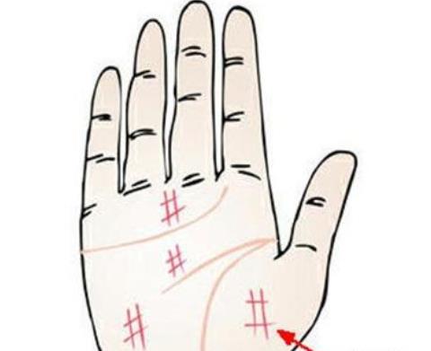便秘|手上有4种变化，说明你的胃不健康了