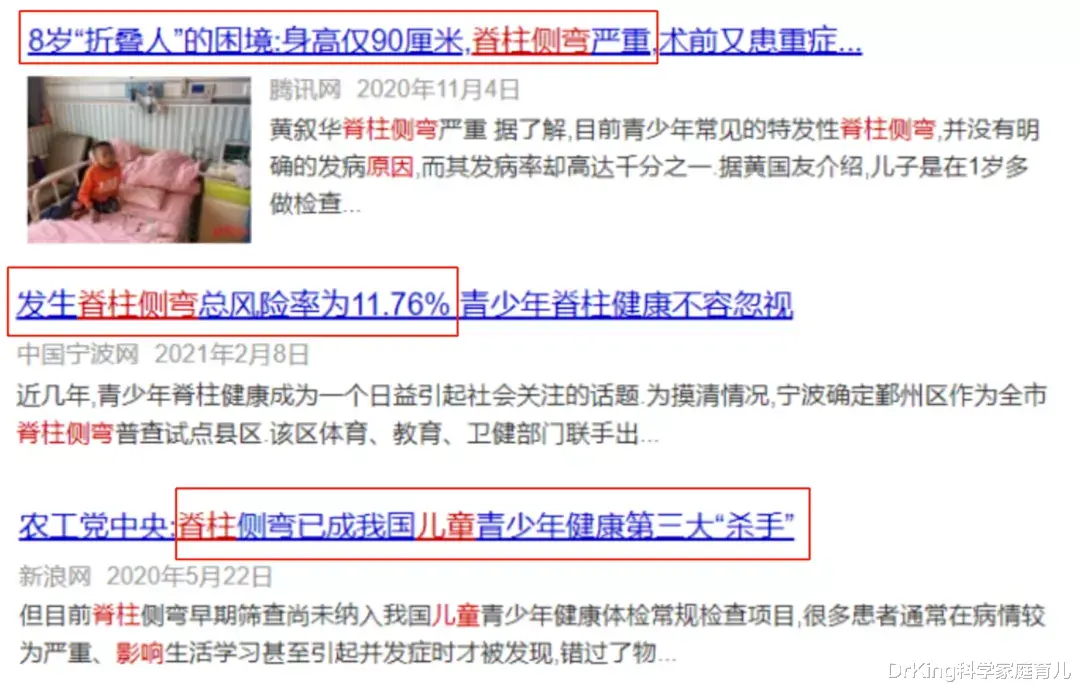 DrKing科学家庭育儿|8岁娃脊柱侧弯成“折叠人”:整个青春期,我都活在壳子里