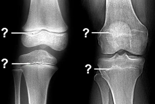 贝贝豆育儿课堂|要想孩子冲破“身高封锁线”，建议家长抓住三个信号，能多长5cm
