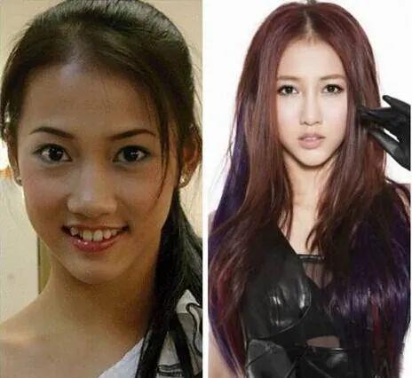 唐嫣|明星的一口乱牙，范冰冰唐嫣整牙后提升颜值，甘望星的牙齿需矫正