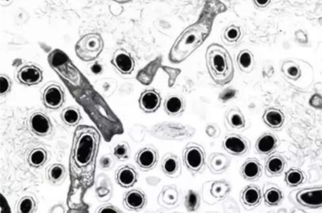 科学家给自己注射了350万年前的细菌，最后成功了吗？让人意外