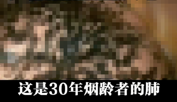39健康网 戒烟后，被熏黑的肺还会白回来吗？患肺癌的概率会降低吗？