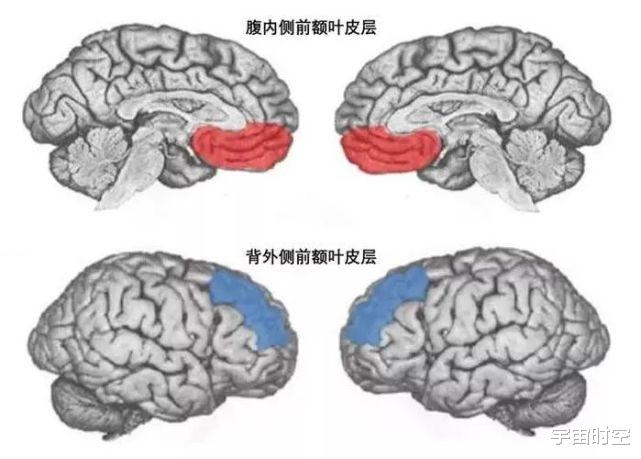 我们在做梦时，为什么不会对梦境里的不合理之处表示怀疑？