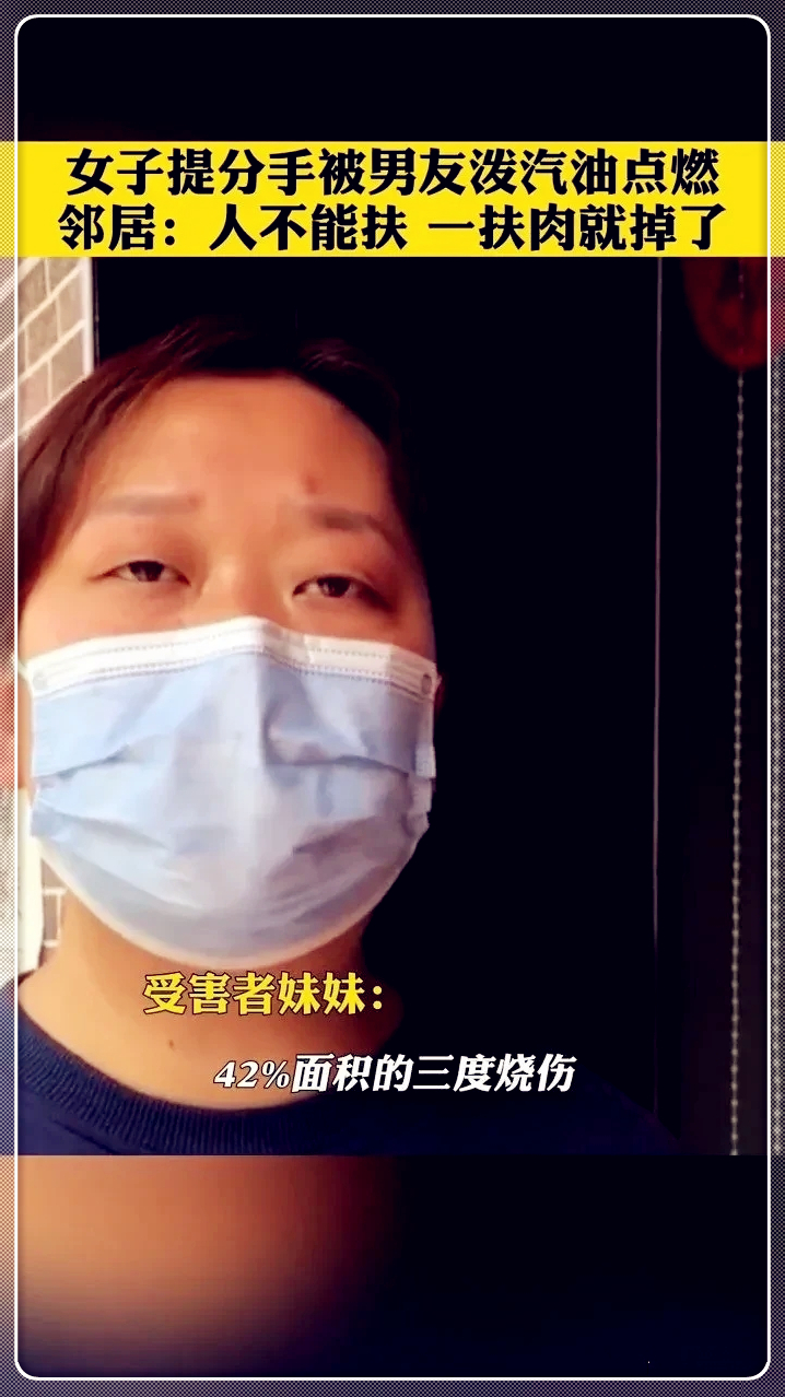 筱筱看社会 因提分手遭男友泼汽油烧伤女子发声:死刑不至于,人活着都不容易