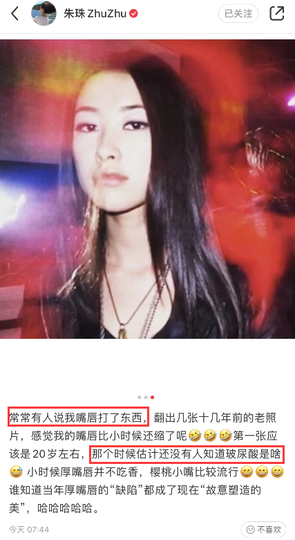 余生|“最美面孔”朱珠晒20岁旧照力证嘴唇未整容，之前称酒窝遗传爸爸
