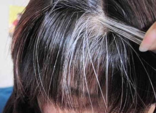 维生素B|为啥白头发越长越多？你以为是老了，医生：或是缺乏2种营养素