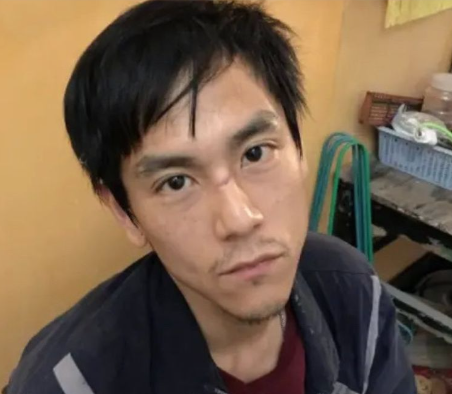 |魏晨婚后素颜出镜变化大！脸颊凹陷眉头紧皱，嘴唇偏白气色差